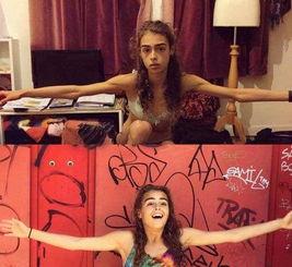 母亲吃瓜进医院视频播放,视频曝光引发网友热议